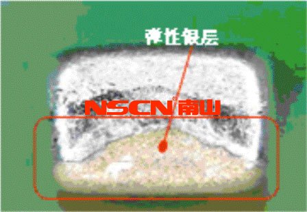 使用柔性端頭降低陶瓷貼片電容短路風險